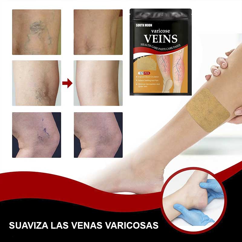 ¡Dile Adiós a las Venas, Arañitas y Cansancio en las piernas! con el Parche Para Venas Varices x 12PCS
