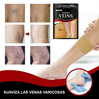 ¡Dile Adiós a las Venas, Arañitas y Cansancio en las piernas! con el Parche Para Venas Varices x 12PCS